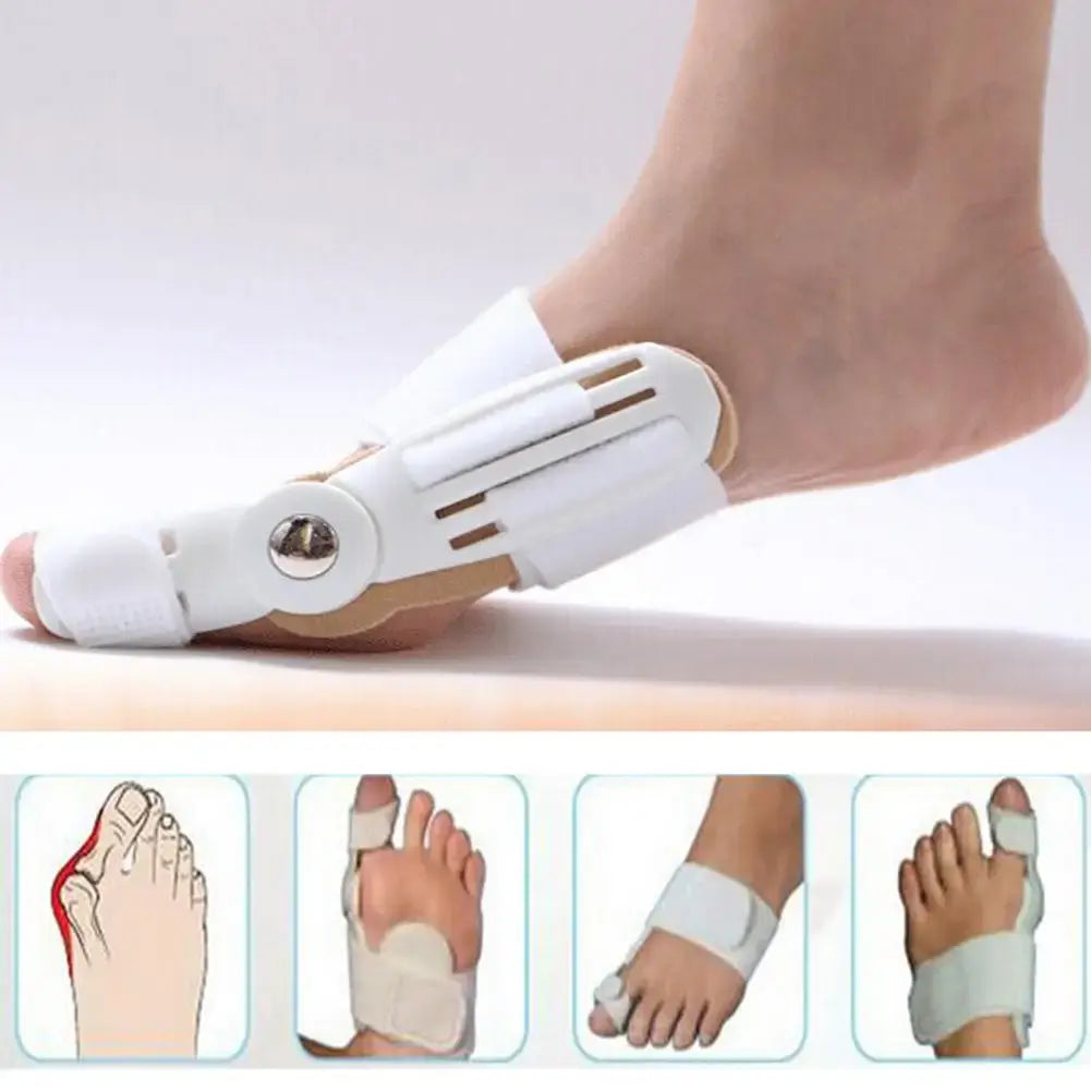 FootAlign: Corrector de Hallux Valgus